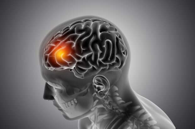 Brain highlighting injury in frontal lobe